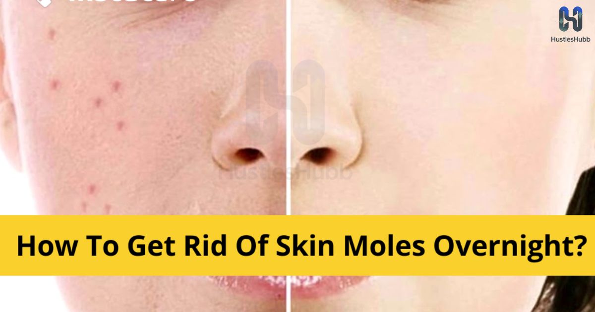 10-safe-and-effective-mole-removal-methods-at-home-–-natural-alternatives-that-work (2)
